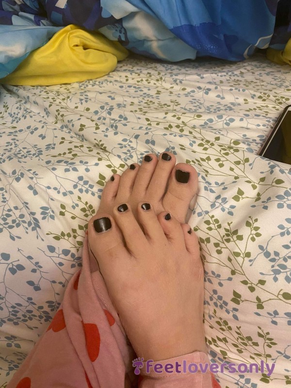 Black Toenails