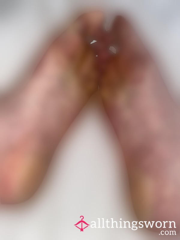 Crusty Dirty Feet