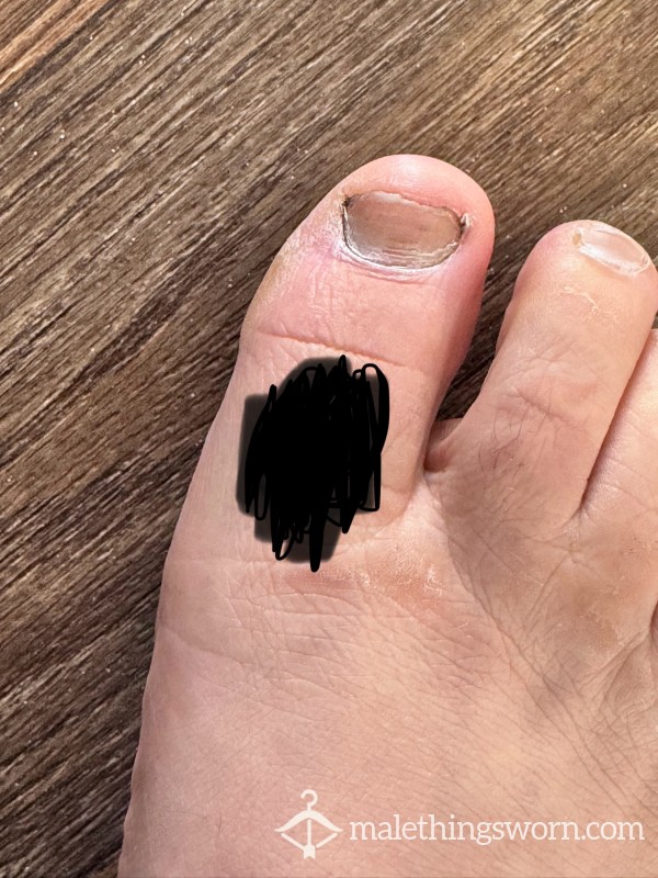 Daddy’s Big Alien Toe