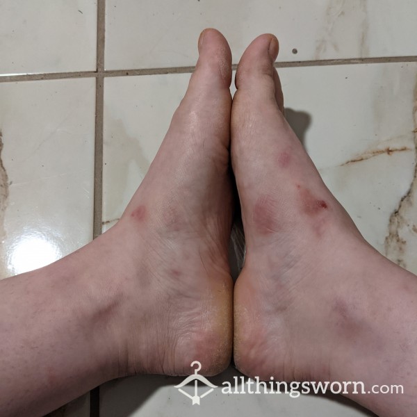 Gross Runners Feet Foot P**l Photo Spread