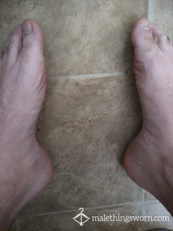 Hairy Feet Pics