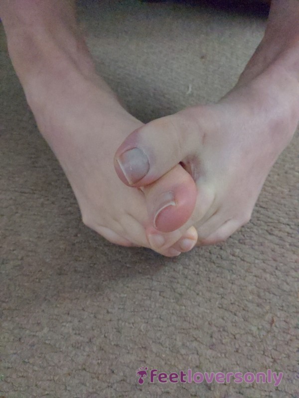 Interlocking Toes