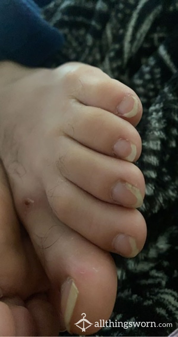 Long Dirty Toenails