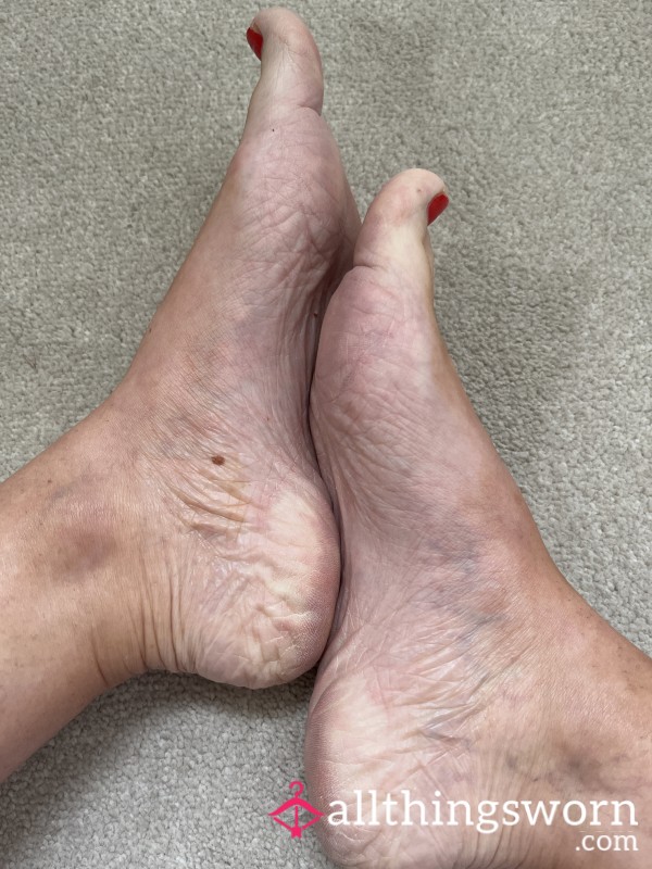 Wrinkly Feet, Rough & Hard Skin Pics