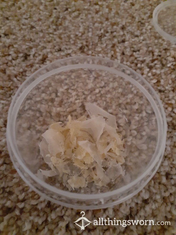 My Juicy Toenail Clippings & Foot Skin