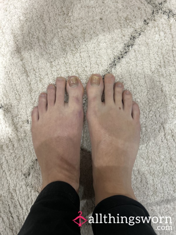 Runners Foot Photos