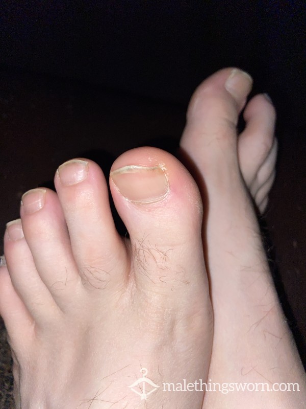 Toe Nails