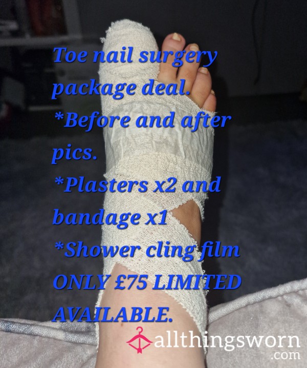 Toe Surgery Package Deal.