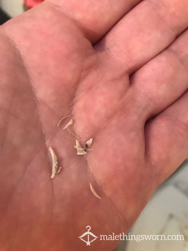 Toenails And Fingernail Clippings From My Trim