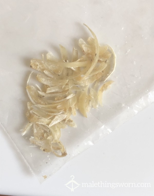 Workman’s Tasty Toenail Clippings