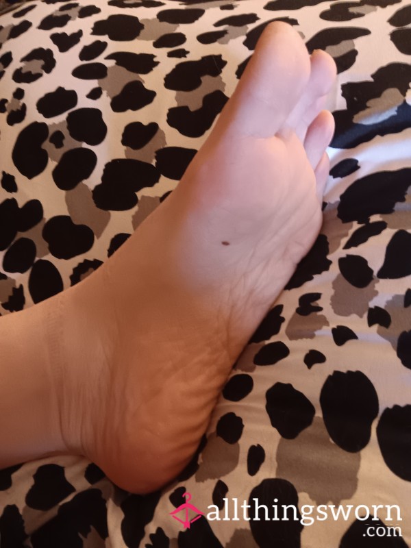 Frecklefoot8